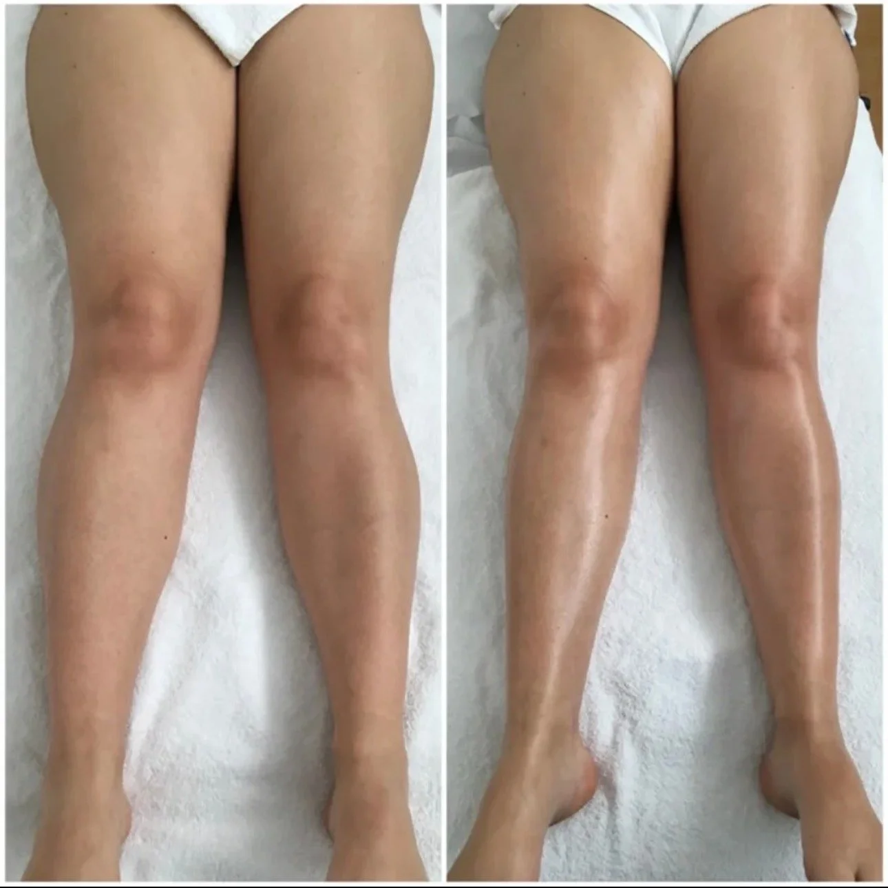 Jambes – 4 séances