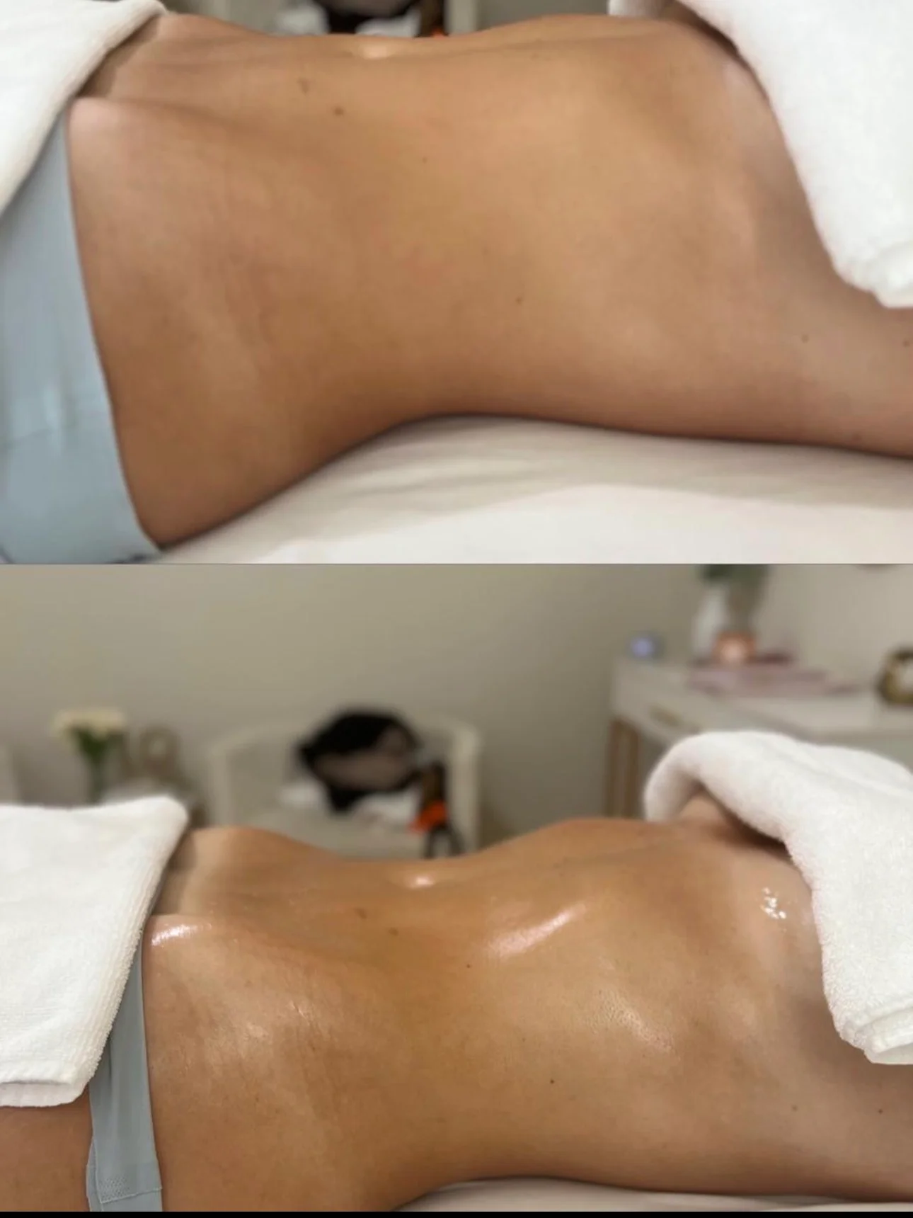 Abdomen – 6 séances